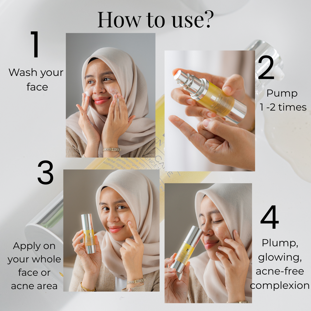 Eileen Grace Acne Care Essence 30ml – Fast-Acting Serum for Pimples | Best Acne Treatment in Malaysia