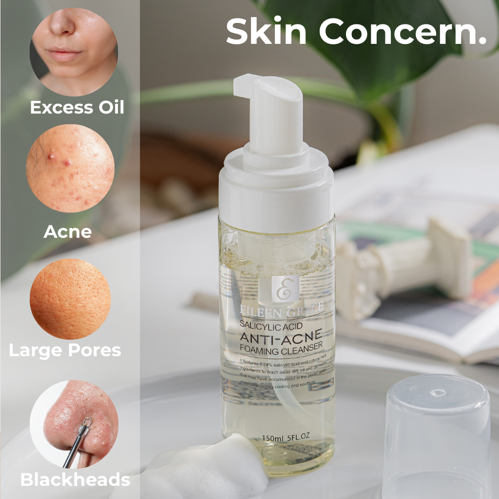Eileen Grace Salicylic Acid Anti-Acne Foaming Cleanser 150ml for excess oil, acne, large pores and blackheads