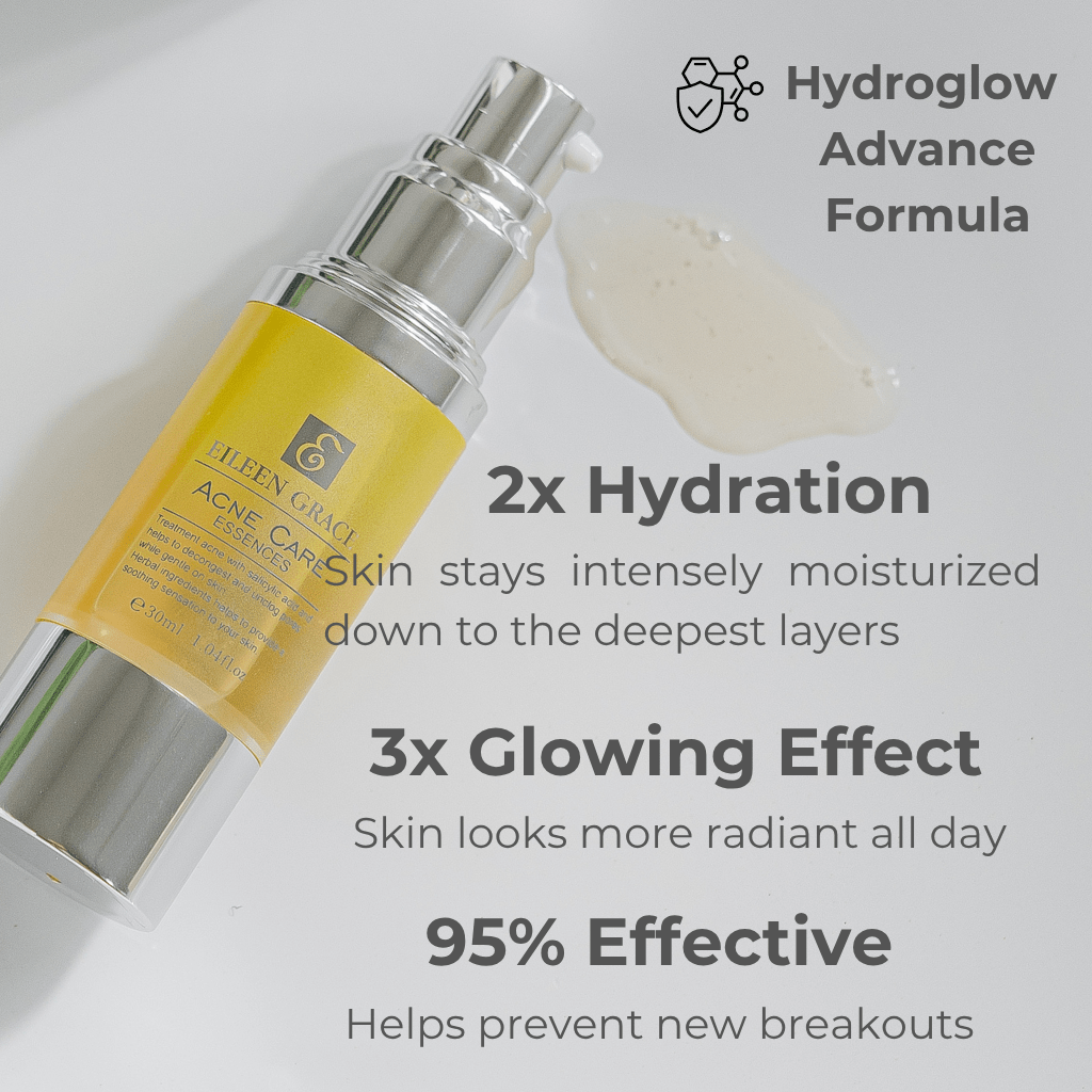 Eileen Grace Acne Care Essence 30ml – Fast - Acting Serum for Pimples | Best Acne Treatment in Malaysia - Eileen Grace Malaysia Official Store