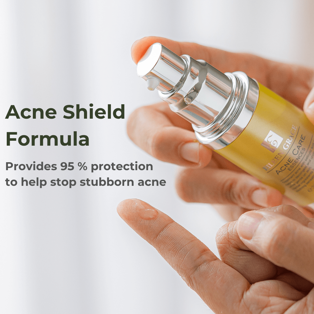 Eileen Grace Acne Care Essence 30ml – Fast - Acting Serum for Pimples | Best Acne Treatment in Malaysia - Eileen Grace Malaysia Official Store