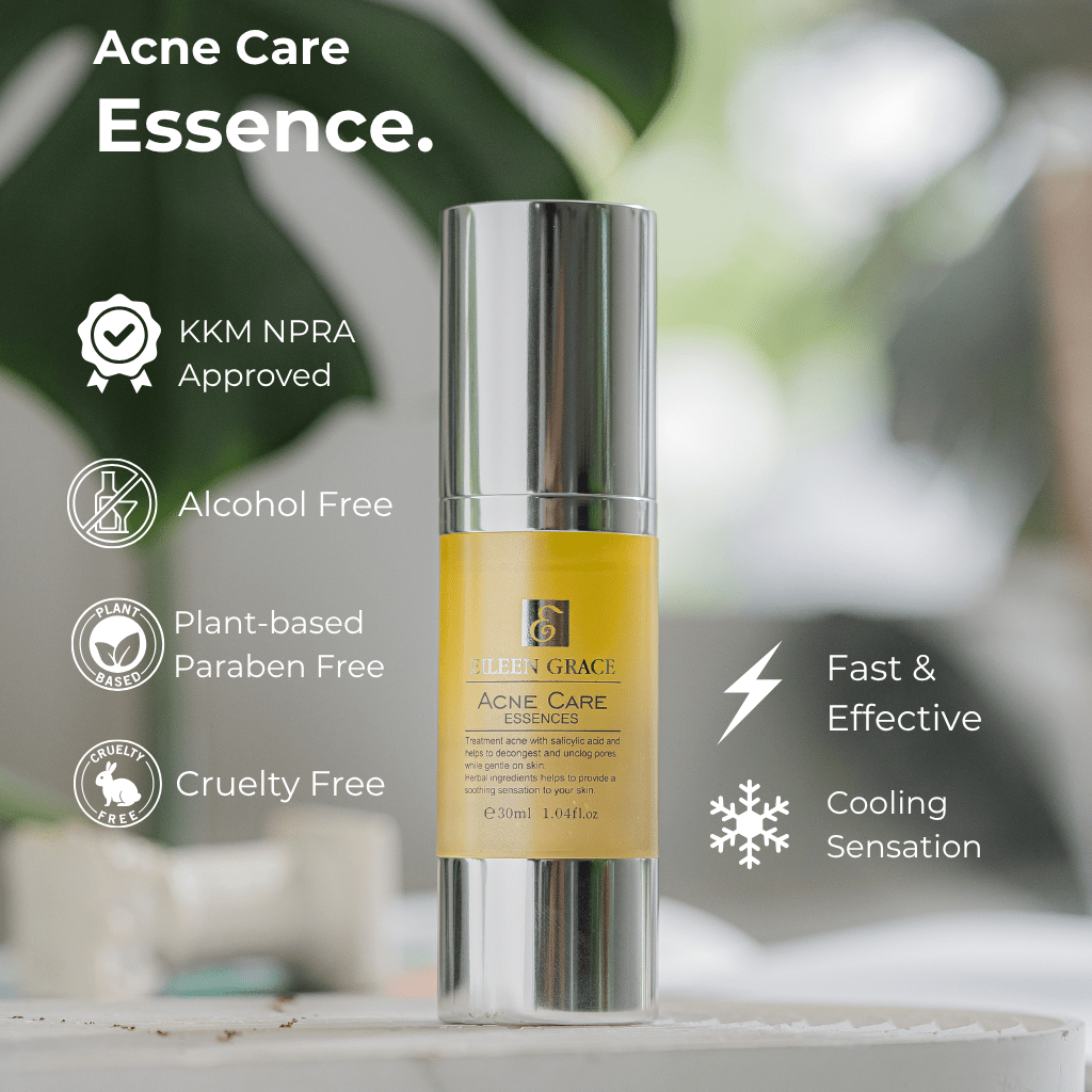 Eileen Grace Acne Care Essence 30ml – Fast - Acting Serum for Pimples | Best Acne Treatment in Malaysia - Eileen Grace Malaysia Official Store