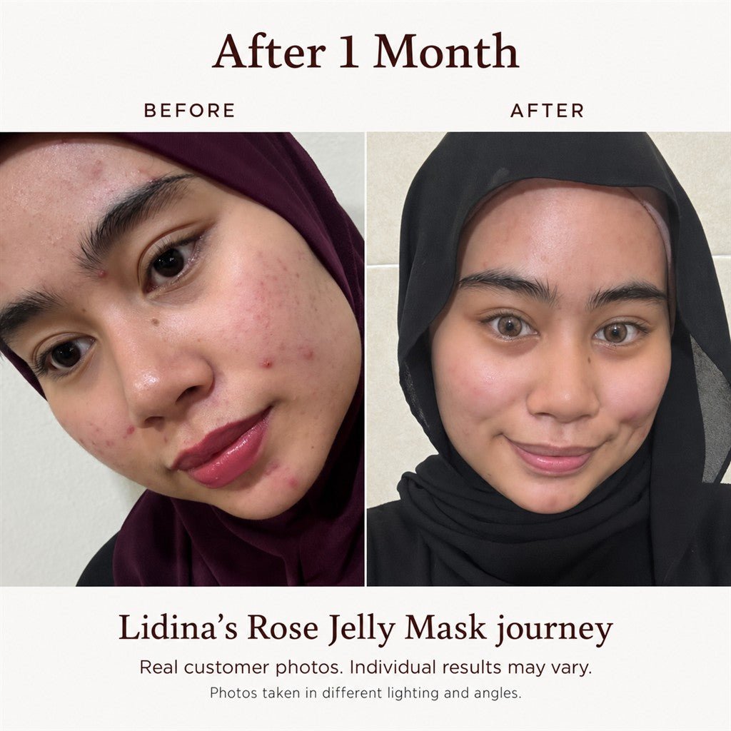 Eileen Grace Moisturize Rose Jelly Mask Trial Pack 35ml - Eileen Grace Malaysia | Viral Jelly Mask & Acne Skincare
